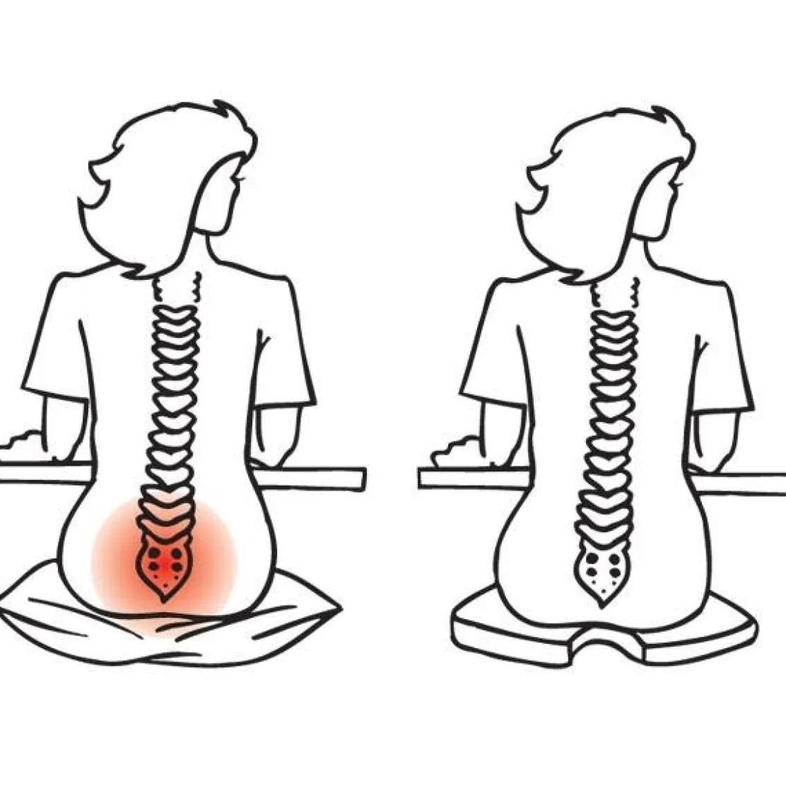 Coussin SEDI CONFORT®