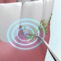 Détartreur ultrasons