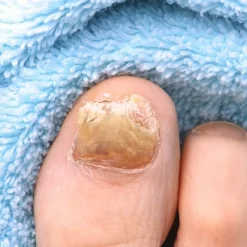 Teinture pour Onyxis Titania®, 10 ml